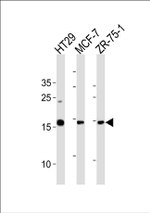 AGR2 Antibody in Western Blot (WB)