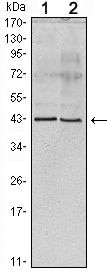 Apolipoprotein A5 Monoclonal Antibody (1G5G9 (c),2G1H11G9B3)