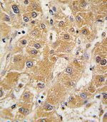 Apolipoprotein A5 Antibody in Immunohistochemistry (IHC)