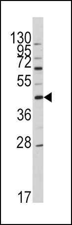 Apolipoprotein A5 Antibody in Western Blot (WB)