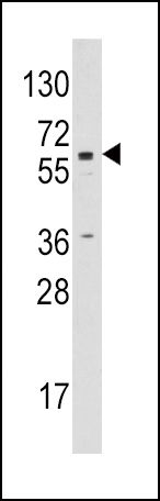 Aromatase Antibody in Western Blot (WB)
