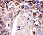Ataxin 3 Antibody in Immunohistochemistry (IHC)