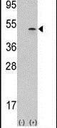 Aurora B Antibody in Western Blot (WB)