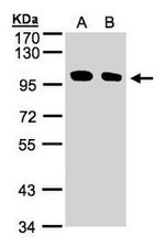 ENPP2 Antibody in Western Blot (WB)
