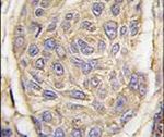 beta-2 Microglobulin Antibody in Immunohistochemistry (IHC)