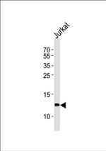 beta-2 Microglobulin Antibody in Western Blot (WB)