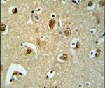 B3GALT6 Antibody in Immunohistochemistry (IHC)