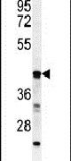 B3GALT6 Antibody in Western Blot (WB)