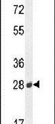 B3GAT2 Antibody in Western Blot (WB)