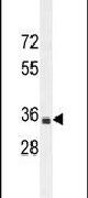 B3GNT4 Antibody in Western Blot (WB)