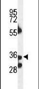 B3GNT4 Antibody in Western Blot (WB)
