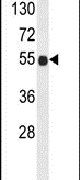 B3GNT6 Antibody in Western Blot (WB)