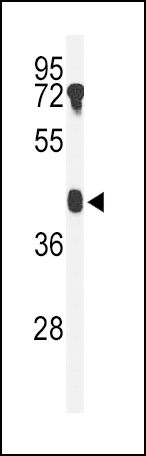 B4GALT2 Antibody in Western Blot (WB)