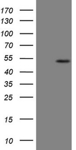 B4GALT4 Antibody in Western Blot (WB)