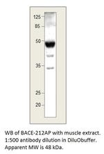 BACE2 B Polyclonal Antibody