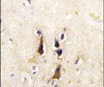 BACE1 Antibody in Immunohistochemistry (IHC)
