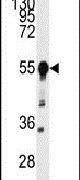 BACE1 Antibody in Western Blot (WB)