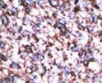BACE2 Antibody in Immunohistochemistry (IHC)