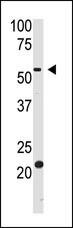 BACE2 Antibody in Western Blot (WB)