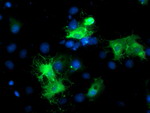 BAIAP2 Antibody in Immunocytochemistry (ICC/IF)