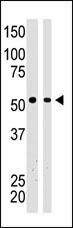 BAIAP2 Antibody in Western Blot (WB)