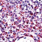 BAK Antibody in Immunohistochemistry (IHC)