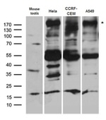 BAZ1A Antibody in Western Blot (WB)