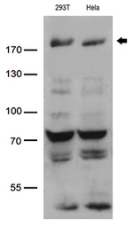 BAZ1B Antibody in Western Blot (WB)