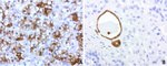 BBOX1 Antibody in Immunohistochemistry (Paraffin) (IHC (P))