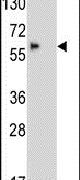 BBS4 Antibody in Western Blot (WB)