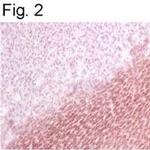 BAP31 Antibody in Immunohistochemistry (IHC)