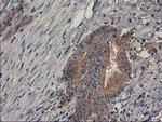 BCAR1 Antibody in Immunohistochemistry (Paraffin) (IHC (P))