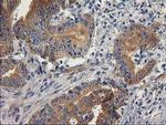 BCAR1 Antibody in Immunohistochemistry (Paraffin) (IHC (P))