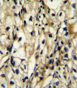 BCAT1 Antibody in Immunohistochemistry (IHC)