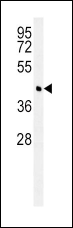 BCAT1 Antibody in Western Blot (WB)