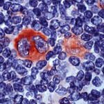 Bcl-X Antibody in Immunohistochemistry (IHC)
