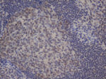 BCL10 Antibody in Immunohistochemistry (Paraffin) (IHC (P))