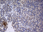 BCL10 Antibody in Immunohistochemistry (Paraffin) (IHC (P))