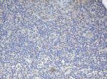 BCL10 Antibody in Immunohistochemistry (Paraffin) (IHC (P))