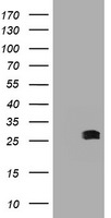 BCL10 Antibody in Western Blot (WB)