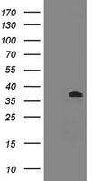 BCL10 Antibody in Western Blot (WB)