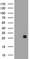 BCL10 Antibody in Western Blot (WB)