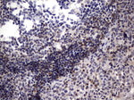 BCL2 Antibody in Immunohistochemistry (Paraffin) (IHC (P))