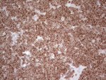 BCL2 Antibody in Immunohistochemistry (Paraffin) (IHC (P))