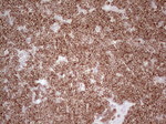 BCL2 Antibody in Immunohistochemistry (Paraffin) (IHC (P))