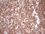 BCL2 Antibody in Immunohistochemistry (Paraffin) (IHC (P))
