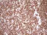 BCL2 Antibody in Immunohistochemistry (Paraffin) (IHC (P))
