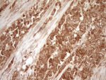 BCL2 Antibody in Immunohistochemistry (Paraffin) (IHC (P))