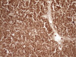 BCL2 Antibody in Immunohistochemistry (Paraffin) (IHC (P))