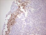 BCL2 Antibody in Immunohistochemistry (Paraffin) (IHC (P))